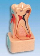 牙齿病变综合病理分解模型Bk-L1004