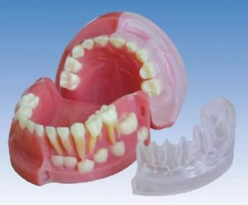 三岁乳恒牙交替解剖模型Bk-L1021